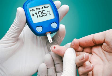fbs (hexokinase)|FBS Test .